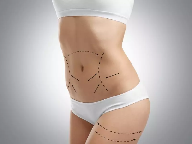 exilis elite saten vücut germe