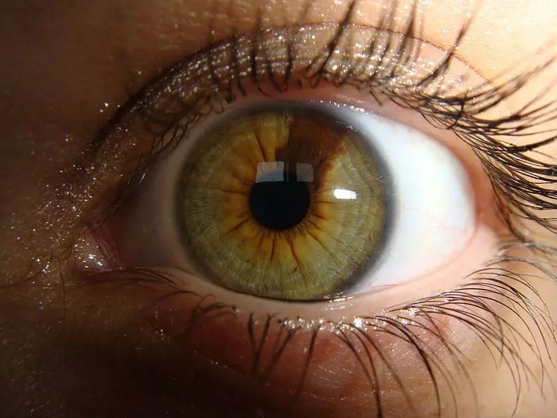 yesil-goz
