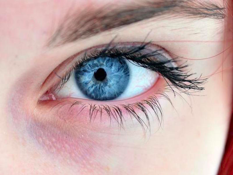 siirt-goz-rengi-degistirme