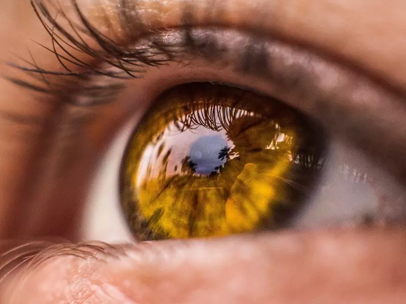 boston laser eye color change