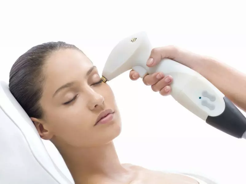 boston laser depigmentation