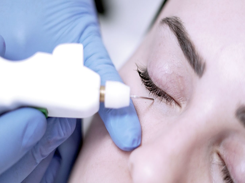 ankara plexr plasma uygulamasi