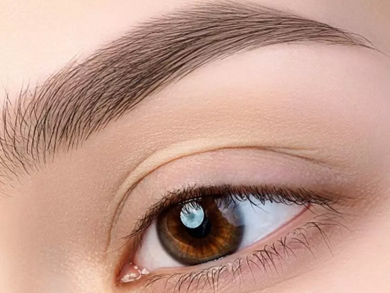 brow lift kac yasinda yapilir
