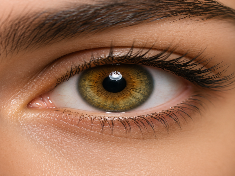eye melanin remover laser