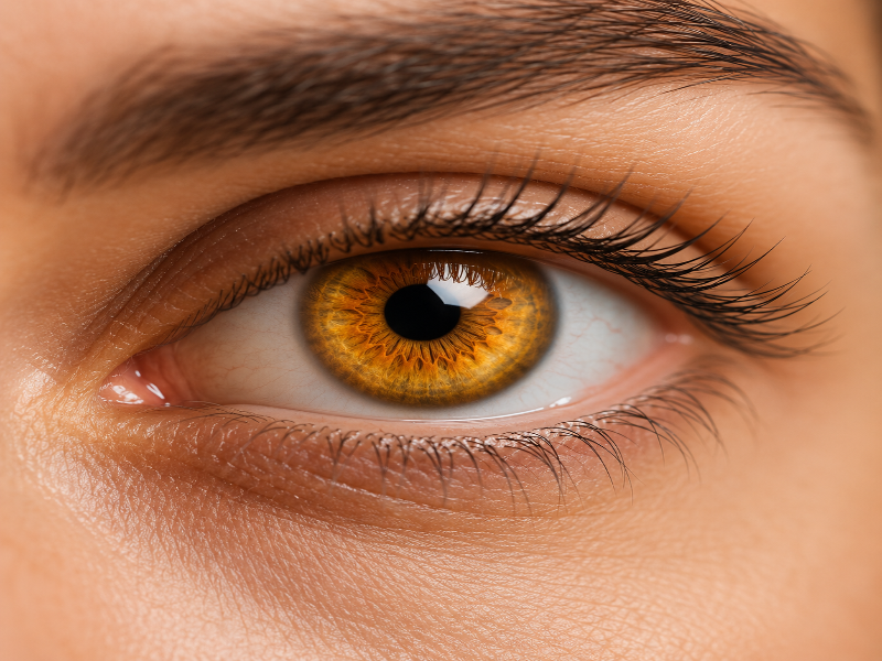 laser depigmentation before after